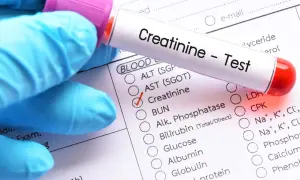 Rękawiczka ochronna trzyma probówkę z krwią do testu kreatyniny. Zaznaczono pole "Kreatynina" na formularzu badań, co może sugerować podwyższona kreatynina we krwi objawy.