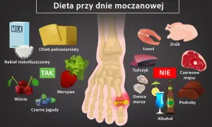 Dieta przy dnie moczanowej: nabiał, chleb pełnoziarnisty, warzywa, wiśnie, czarne jagody - TAK. Unikaj łososia, drobiu, tuńczyka, czerwonego mięsa, owoców morza, podrobów i alkoholu.