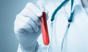 Ręka w białej rękawiczce trzyma probówkę z czerwonym płynem. Lekarz z zielonym stetoskopem martwi się, że pdw za niskie.