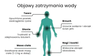 Objawy zatrzymania wody w organizmie: opuchlizna twarzy, dłoni, brzucha, nóg i kostek, a także gwałtowne skoki masy ciała.