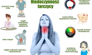 Niedoczynność tarczycy objawy: przyrost masy ciała, zmęczenie, bóle mięśni, wahania nastroju, sucha skóra, wypadanie włosów, problemy z pamięcią.