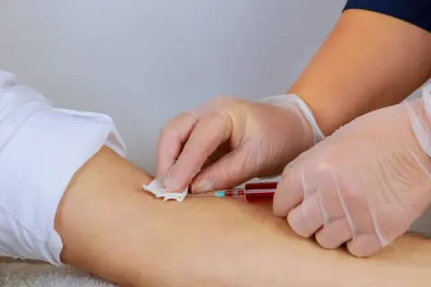 Pielęgniarka pobiera krew do strzykawki. Warto zadbać o odpowiedni poziom hemoglobiny przed oddaniem krwi, by pomóc innym.