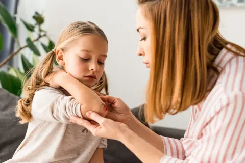 Mama opatruje łokieć córki, na którym widać zaczerwienienie i otarcie. Dziecko ma zamknięte oczy, jakby bolało je to **trudno gojące się rany**.