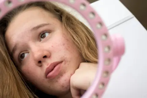 Dziewczyna zmagająca się z trądzikiem u nastolatka spogląda w różowe lusterko, analizując swoją skórę.