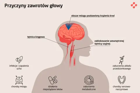 Ilustracja pokazuje przyczyny zawrotów głowy: problemy z tętnicami, mózgiem, uchem, leki, metabolizm, układ przedsionkowy i serce.