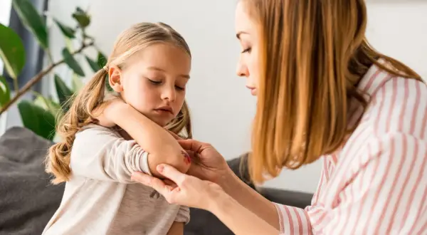 Mama opatruje łokieć córki, na którym widać zaczerwienienie i otarcie. Dziecko ma zamknięte oczy, jakby bolało je to **trudno gojące się rany**.
