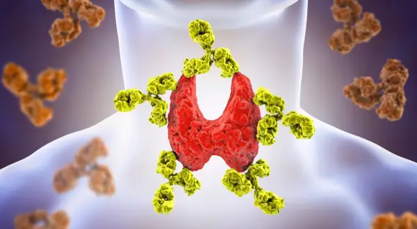 Zielone przeciwciała atakują czerwony gruczoł tarczycy, co wywołuje choroby autoimmunologiczne. W tle widać inne przeciwciała.