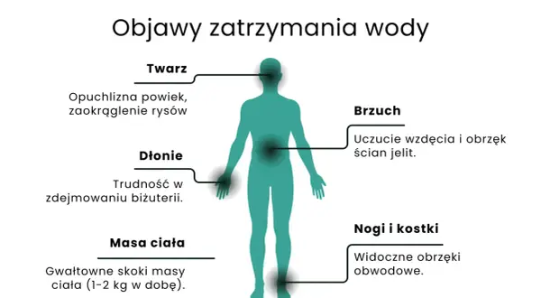 Objawy zatrzymania wody w organizmie: opuchlizna twarzy, dłoni, brzucha, nóg i kostek, a także gwałtowne skoki masy ciała.
