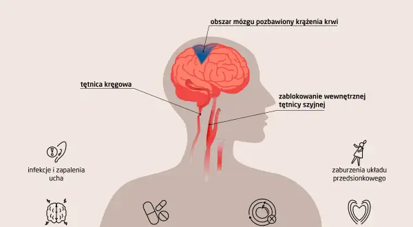Ilustracja pokazuje przyczyny zawrotów głowy: problemy z tętnicami, mózgiem, uchem, leki, metabolizm, układ przedsionkowy i serce.