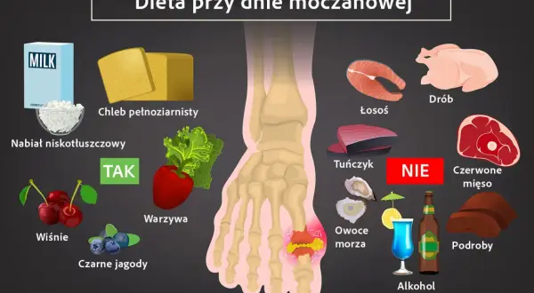Dieta przy dnie moczanowej: nabiał, chleb, warzywa, owoce (wiśnie, jagody) - TAK. Ryby, drób, alkohol, podroby, czerwone mięso - NIE. Pomaga obniżyć podwyższony kwas moczowy.