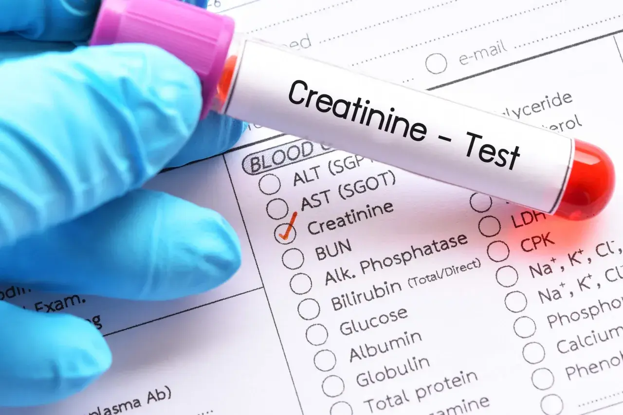 Rękawiczka ochronna trzyma probówkę z krwią do testu kreatyniny. Zaznaczono pole "Kreatynina" na formularzu badań, co może sugerować podwyższona kreatynina we krwi objawy.