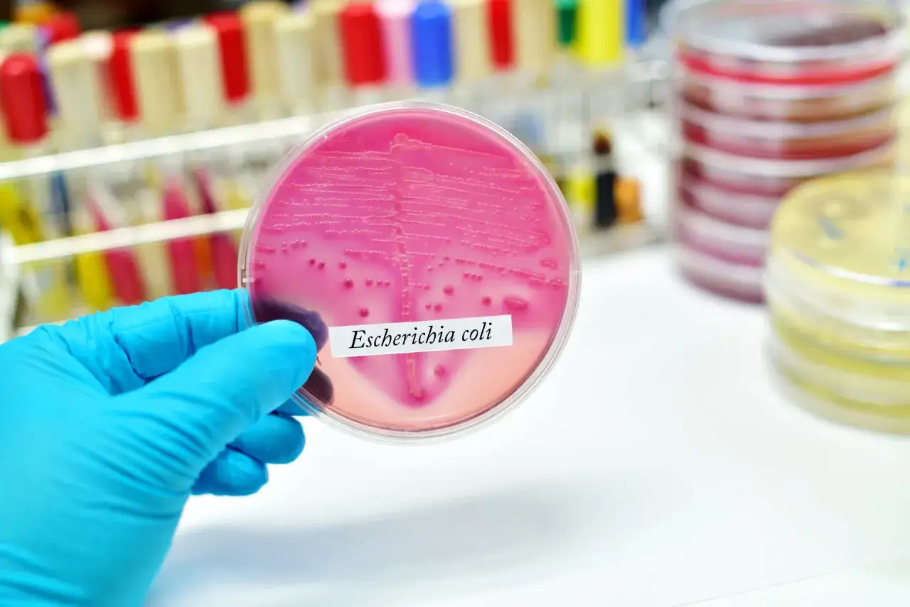 Różowe kolonie bakterii Escherichia coli na podłożu, wskazujące na obecność bakterii coli w moczu.
