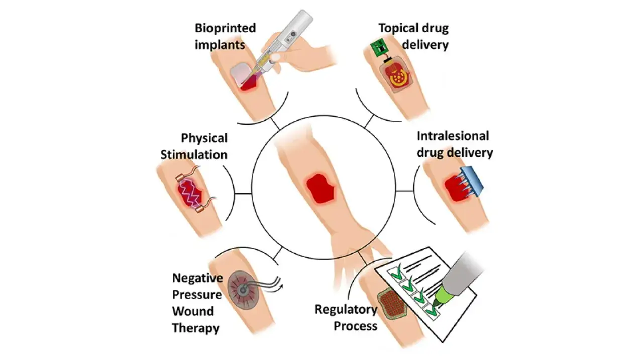 Ilustracja pokazuje metody leczenia trudno gojących się ran: bioprinting, dostarczanie leków miejscowo i podskórnie, stymulację fizyczną, terapię podciśnieniową i proces regulacyjny.