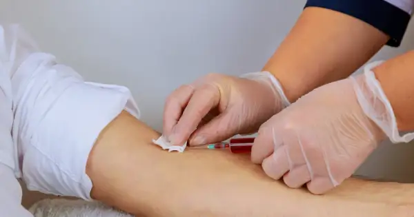 Pielęgniarka pobiera krew do strzykawki. Warto zadbać o odpowiedni poziom hemoglobiny przed oddaniem krwi, by pomóc innym.
