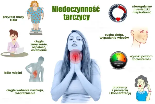 Niedoczynność tarczycy objawy: przyrost masy ciała, zmęczenie, bóle mięśni, wahania nastroju, sucha skóra, wypadanie włosów, problemy z pamięcią.