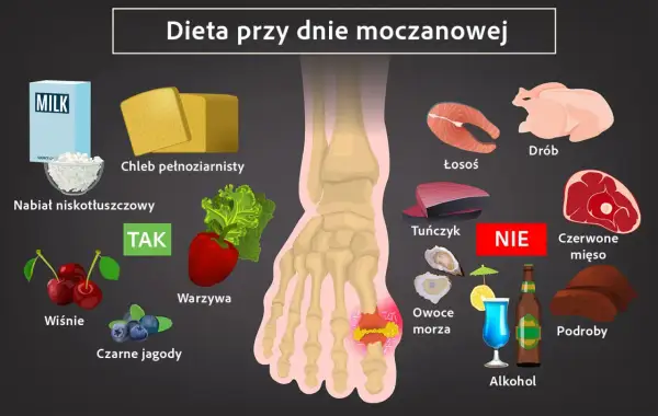 Dieta przy dnie moczanowej: nabiał, chleb, warzywa, owoce (wiśnie, jagody) - TAK. Ryby, drób, alkohol, podroby, czerwone mięso - NIE. Pomaga obniżyć podwyższony kwas moczowy.